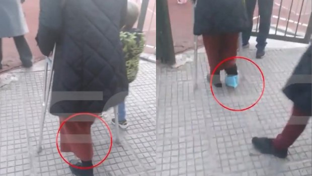 Ζωγράφου: Υποχρέωσαν νηπιαγωγό να γυρίσει στο σχολείο με σπασμένο πόδι – «Ζητάω ίσα δικαιώματα»