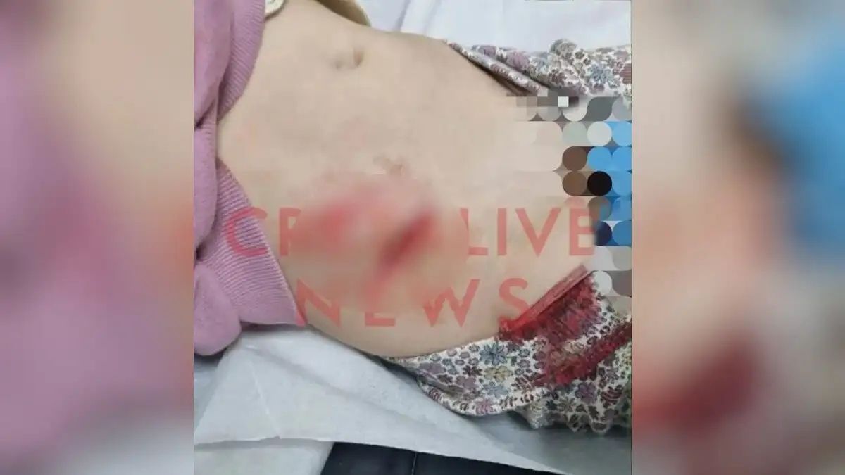 Ηράκλειο: Κοριτσάκι 4,5 χρόνων έπεσε σε φρεάτιο γεμάτο με κοφτερές λαμαρίνες